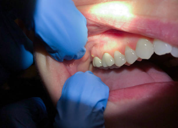 Best Broken Tooth Emergency  in Brooklyn Center, MN