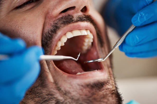 Best Cracked Tooth Emergency Dentist  in Brooklyn Center, MN