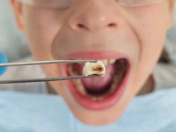Best Teeth Whitening  in Brooklyn Center, MN